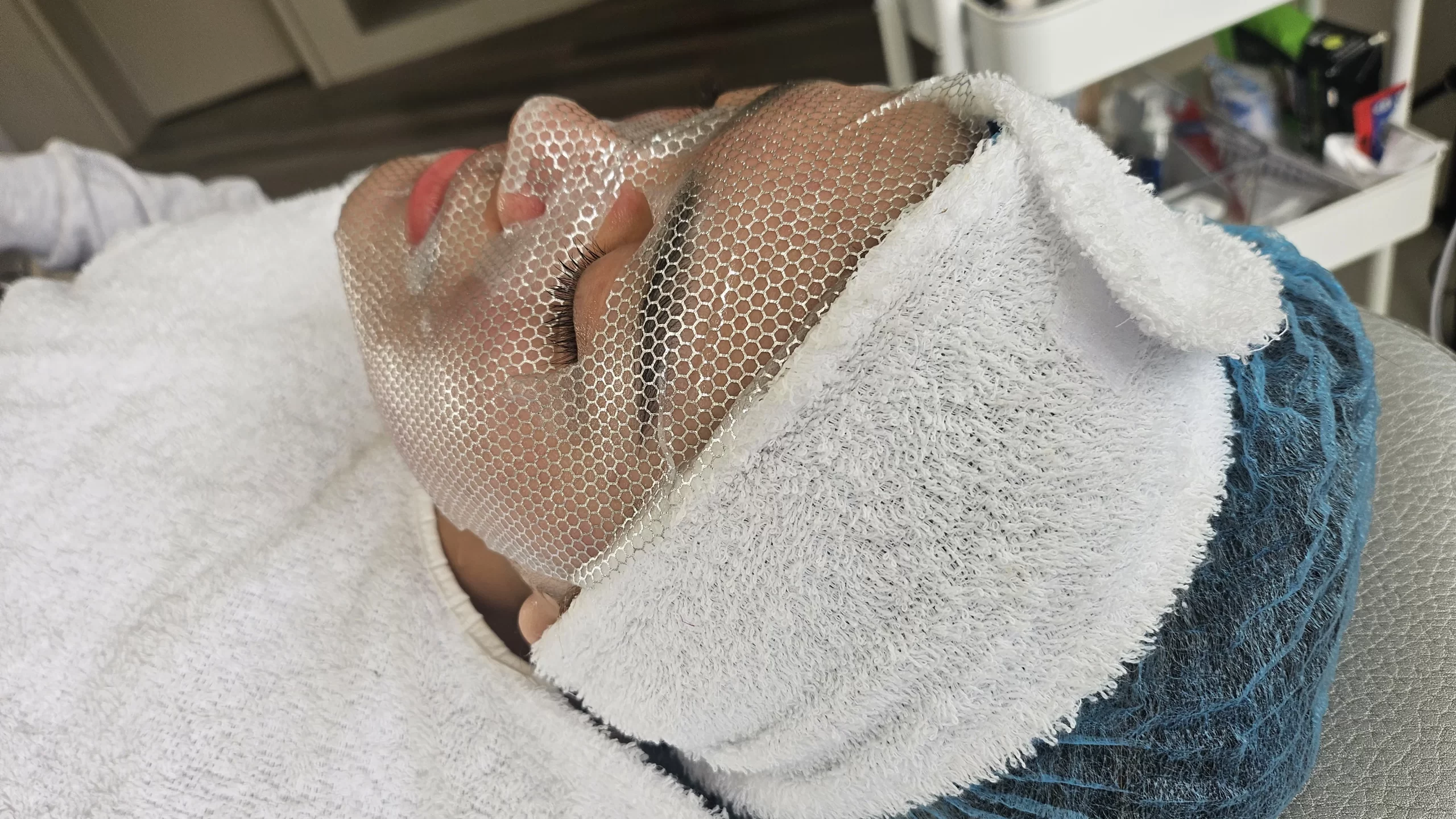 Estética facial avanzada